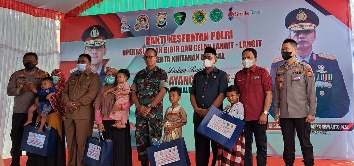 FKG Unhas Gelar Operasi Gratis Celah Bibir dan Lelangit di Kota Ternate post thumbnail image